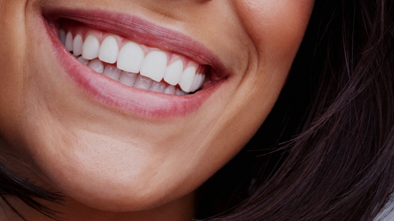 Close up of smile with flawless teeth