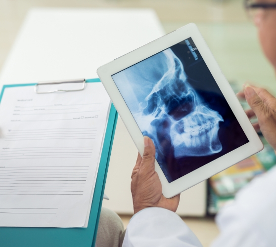 Two dentists looking at x ray of skull