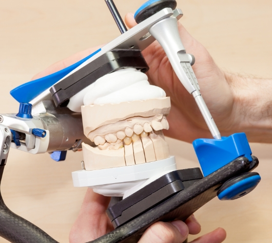 Dentist holding a model of the jaws in an adjustment machine